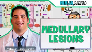 Medullary Lesions Medial and Lateral Medullary Syndromes [upl. by Lustick385]