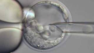 ES cell microinjection into a mouse blastocyst [upl. by Kam]