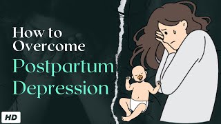 Postpartum Depression [upl. by Aile]