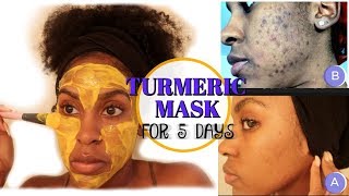 I Used a TURMERIC MASK for 1 Week and THIS HAPPENED  How to Fade Dark Spots [upl. by Barstow952]