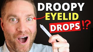 The Best treatment Options for Droopy Eyelids Ptosis  Patient experience  Ptosis treatment [upl. by Eislrahc]