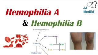 Hemophilia A vs Hemophilia B  Genetics Symptoms and Treatment [upl. by Goulet778]