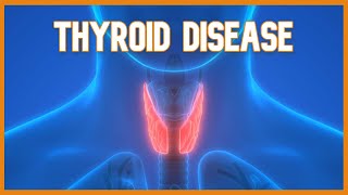 Thyroid Disease Hyperthyroidism vs Hypothyroidism [upl. by Anwaf]