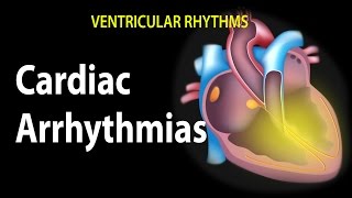 Cardiac Arrhythmias Animation [upl. by Vareck]