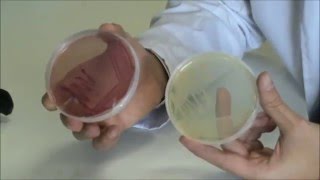 Técnicas básicas de Microbiología Morfología de Escherichia coli en diferentes medios de cultivo [upl. by Aihsyt]