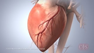 Myocardial Infarction Heart Attack Ischemia Pathophysiology ECG Nursing Signs Symptoms Part 1 [upl. by Edieh300]