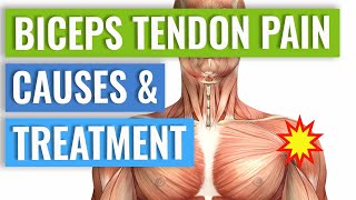 Biceps Tendonitis Treatment and Exercises Explained [upl. by Hpeseoj]