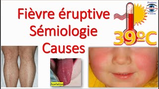 Fièvre éruptive Sémiologie Éruption erythemato maculo papuleuse vésiculeuse purpura Toxidermie [upl. by Greenwell]