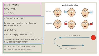 Tests for carpal tunnel syndrome  BMJ Learning [upl. by Lyrahs]