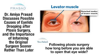 Pulmonary Tuberculosis in Hindi  Stages  Causes  Pathophysiology  Sign amp Symptoms [upl. by Themis]