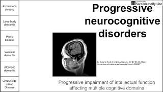 Progressive Neurodegenerative Disorders [upl. by Telracs972]