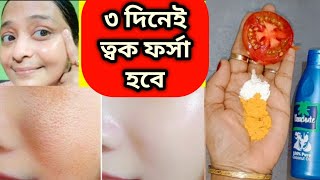 ফর্সা হবার সহজ উপায়েforsa howar sohoj upaytomato facialGlow Facial [upl. by Ottie]