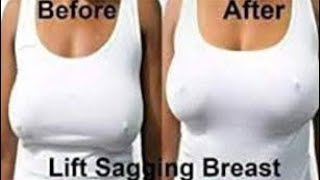 How to Permanently Lift Sagging Breast Naturally  100 Working [upl. by Nuawad459]