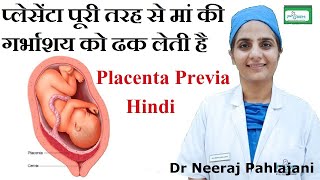 Placenta Previa होने के लक्षण इलाज और Low Lying Placenta से कैसे बचे [upl. by Asilej320]