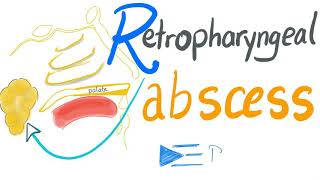 Retropharyngeal Abscess [upl. by Mccandless710]