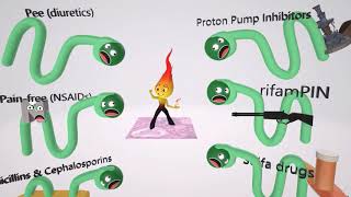 Acute Nephritic Syndrome Fundamentals – Nephrotic Syndrome  Lecturio [upl. by Nnylamme]