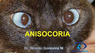 Anisocoria [upl. by Walter306]