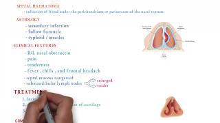 septal abscess  ent lecture [upl. by Hussar23]