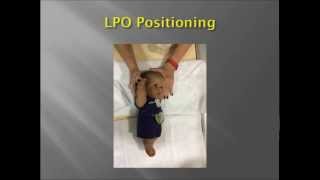 Pediatric Upper GI Fluoroscopy exam [upl. by Reiche]