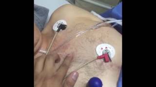 ¿Cómo hago un Electrocardiograma ¡En emergencias [upl. by Oicangi]