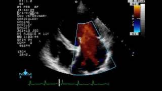 Echocardiography to Assess MitralValve Leaflets  NEJM [upl. by Wylie279]