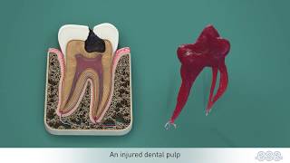 Endodontic treatments [upl. by Padget]