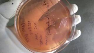 Pseudomonas typical colony on MacConkey agar [upl. by Aihtibat]