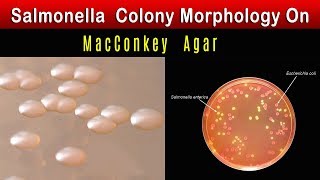 Salmonella Colony Morphology On MacConkey agar [upl. by Enidlareg]