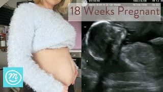 18 Weeks Pregnant What You Need To Know  Channel Mum [upl. by Ainwat64]