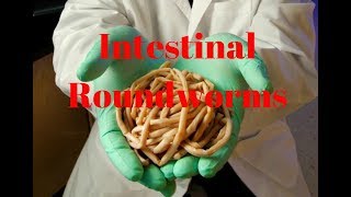 Parasites Intestinal Roundworms Nematodes [upl. by Terrijo488]