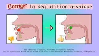 Problème de déglutition  que faire [upl. by Tecu]