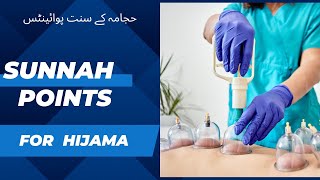 Sunnah Points For Hijama Cupping Therapy [upl. by Ahsitram47]