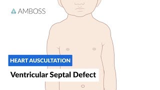 Ventricular Septal Defect VSD  Heart Auscultation  Episode 11 [upl. by Louls]