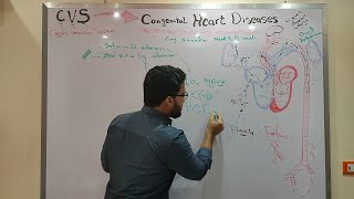 CVS Module  Congenital heart diseases part 1 [upl. by Keriann40]