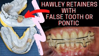 Hawley RETAINERS with FALSE TOOTH or Pontic  PHILIPPINES [upl. by Siver935]