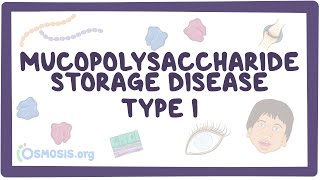 Mucopolysaccharide Storage Disease Type I Hurler HurlerScheie and Scheie syndromes [upl. by Yxor]