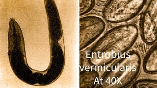 Entrobius vermicularis Pin Worm under microscope at 40 X [upl. by Nodnrb]