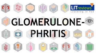 Glomerulonephritis [upl. by Ardnasyl]