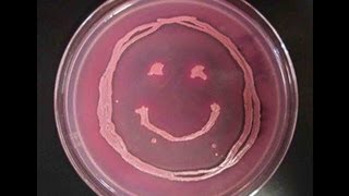 How to Interpret MacConkeys Agar Bacterial Growth Medium [upl. by Yemaj570]