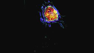 Apoptosis Programmed Cell Death  Live and in 3D [upl. by Llednar]