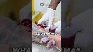 WHAT IS HIJAMA EXPLAINED [upl. by Ardnahc]