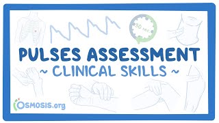 Clinical Skills Pulses assessment [upl. by Loella]