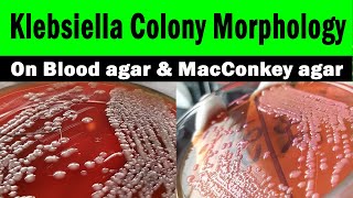 Klebsiella colony morphology on macConkey agar  Blood agar Clear explanation with live video [upl. by Ailadgim]