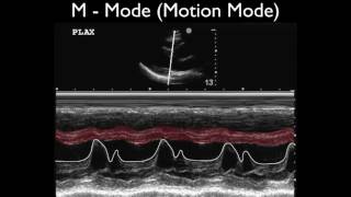 Ultrasound Physics Scanning Modes M Mode [upl. by Dami]