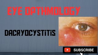 Dacryocystitis  Causes Symptoms Treatment [upl. by Laamak]