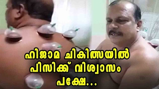 Hijama Treatment And Controversy  Oneindia Malayalam [upl. by Hotze]