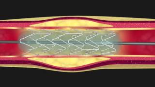 PROMED ostéologie  le sternum [upl. by Enelrae56]