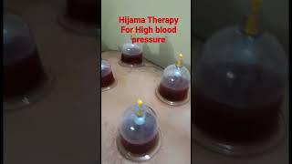 Hijama Therapy for High blood pressure [upl. by Radie711]