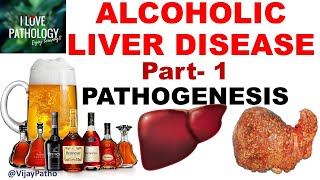 ALCOHOLIC LIVER DISEASE Part 1 Pathogenesis [upl. by Neile]