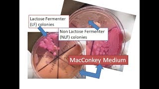 MacConkey medium showing lactose and non lactose fermenter colonies [upl. by Htebazila]